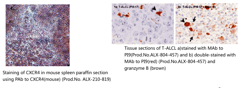 乳腺癌抗药性蛋白单克隆抗体 (BXP-53)                  Breast cancer resistance protein, mAb (BXP-53)