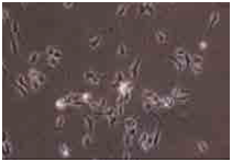 人iPS细胞来源的胆碱神经元祖细胞                  ReproNeuro Ach ™ kit