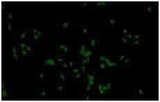 人iPS细胞来源的胆碱神经元祖细胞                  ReproNeuro Ach ™ kit