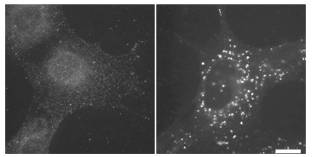 抗LC3（克隆号：LC3・1703）单克隆抗体                  Anti LC3 (Clone: LC3-1703) monoclonal antibody