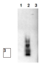 β淀粉样多肽                  Amyloid β