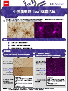 兔源Iba1抗体，有标签                  Anti Iba1, Rabbit (for Immunocytochemistry)