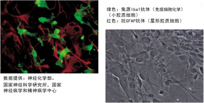 兔源Iba1抗体，无标签                  Anti Iba1, Rabbit