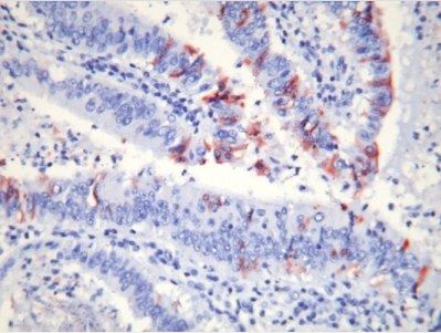 细胞凋亡M30 CytoDEATH™ 抗体                  M30 CytoDEATH™ antibodies