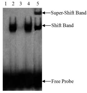EMSA/Gel-Shift 试剂盒(GS002)