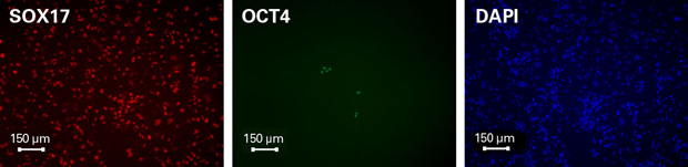 Human Stem Cell Derived Definitive Endoderm Cells