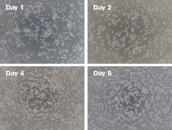 Human Stem Cell Derived Microglia